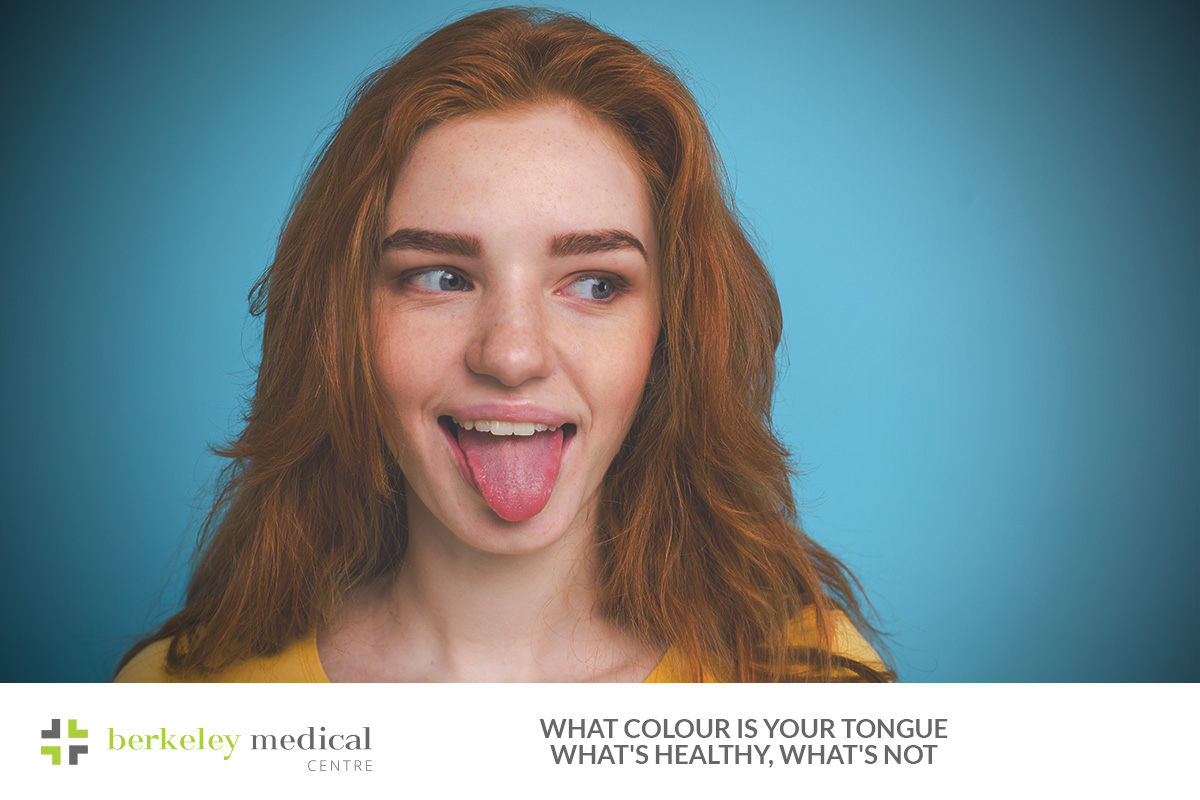 What Your Tongue’s Colour Says About Your Health