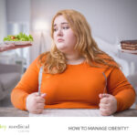 How to Manage Obesity