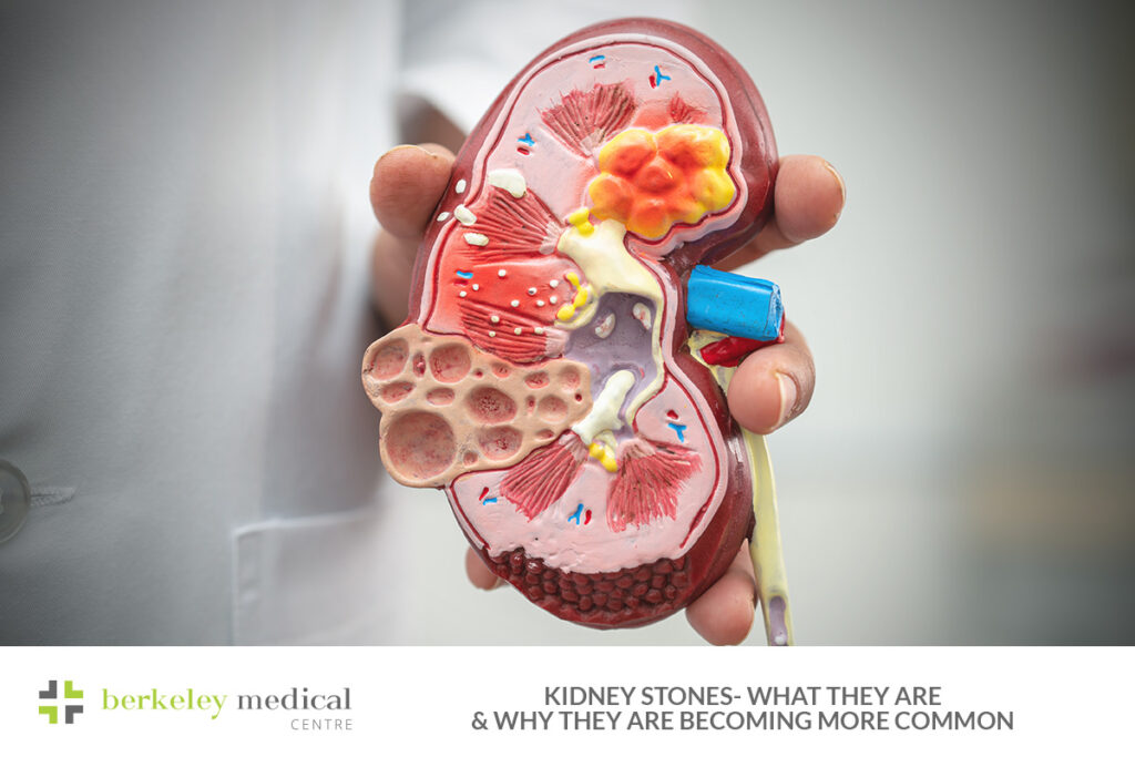Visual Reference: Kidney Stones What They Are And Why Are They Becoming