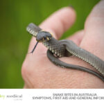 Snake Bites in Australia: Symptoms, First Aid and General Information
